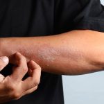 Bumps and Rough Patches