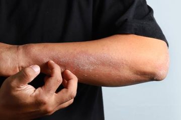 Bumps and Rough Patches? Here’s How to Get Even Skin